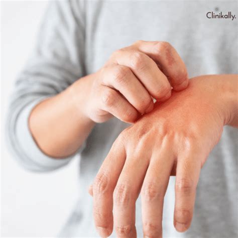 Unlocking the Potential of Metronidazole: The Ultimate Guide