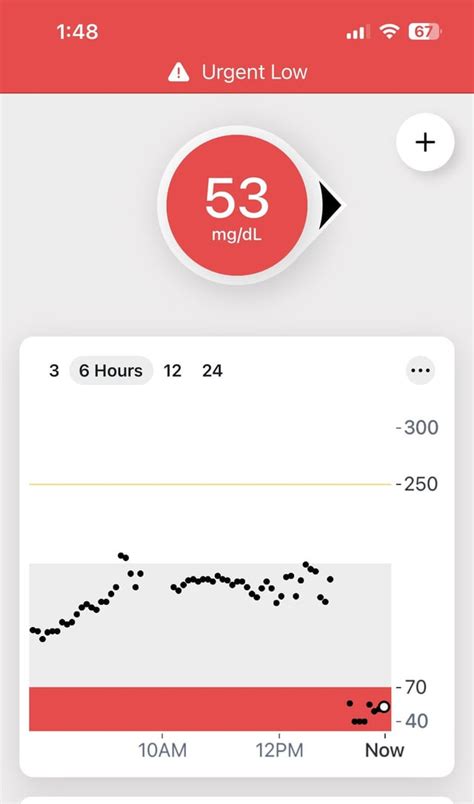 Dexcom G6 Problems 的图像结果