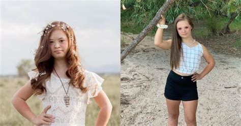 #अलग हैं, पर पागल नहीं: मिलिए ऐसे 7 लोगों से जो डाउन सिंड्रोम से जुड़ी ...