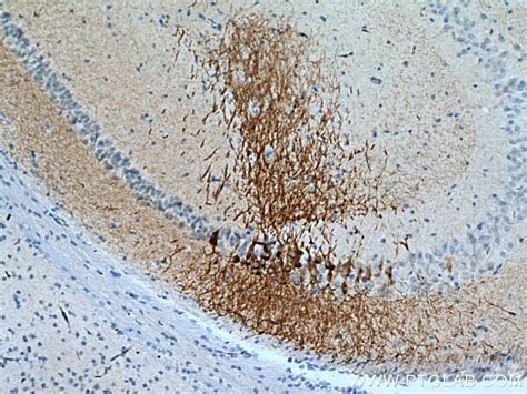 RGS14 antibody (16258-1-AP) | Proteintech