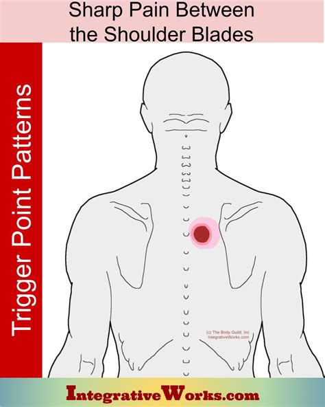 Sharp Pain Between the Shoulder Blades - Integrative Works