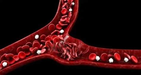 Initial Gene-Editing Trials Show Positive Results In Treating Blood ...