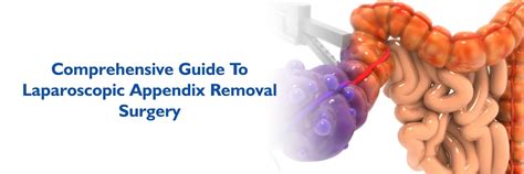 Appendix Removal Surgery 的图像结果