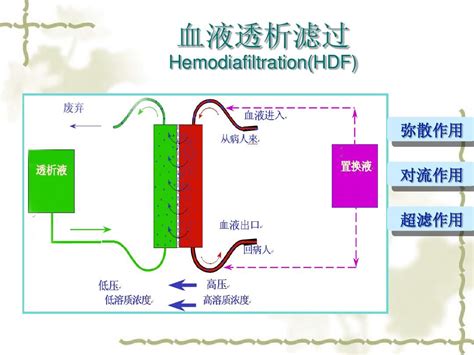 CRRT Recirculation 的图像结果