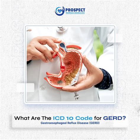 What Is the ICD 10 Code for GERD | Simple Guide to K21.9