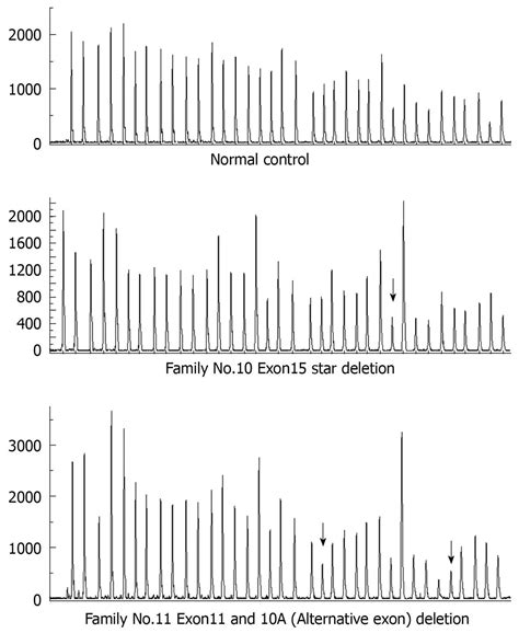 APC gene mutations in Chinese familial adenomatous polyposis patients