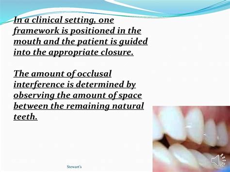 Clinical removable prosthodontics. Fitting the framework - online ...