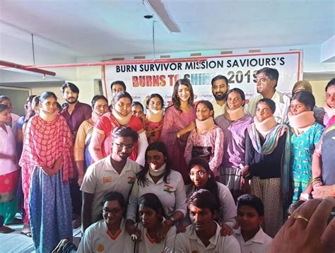Attempted suicide because of burns but survived, is now helping other ...