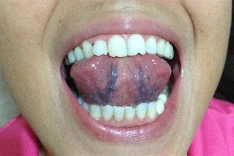 舌下爆青筋，或许是这个部位淤血了，做好2件事，帮你清除淤血|青筋|淤血|舌头_新浪新闻