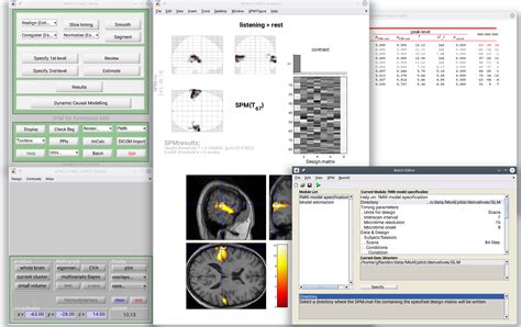 Image result for MATLAB SPM Model Analysis