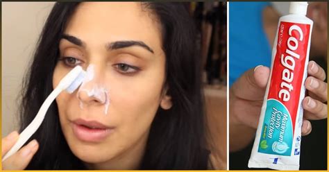 Toothpaste On Dark Spots 的图像结果