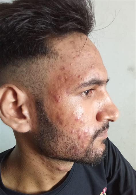 Radioloksabha - Articles