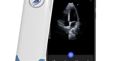 The Working Principle of Ultrasonic Probe — Teletype