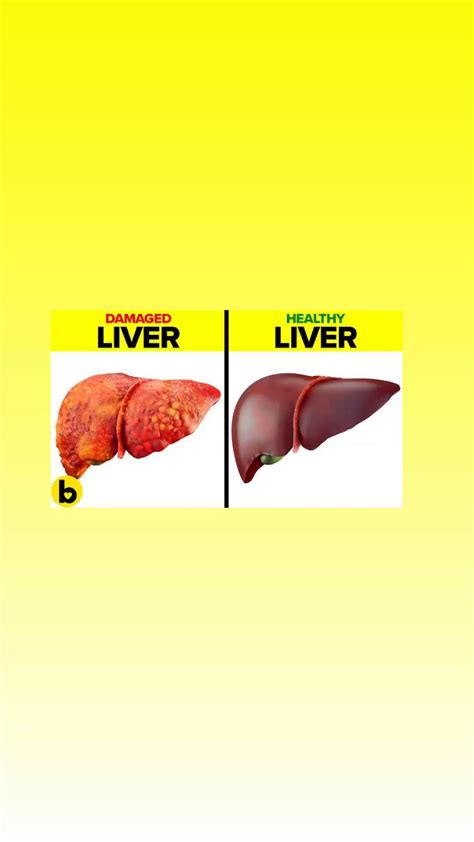 What does liver taste like liver taste explained tastylicious – Artofit