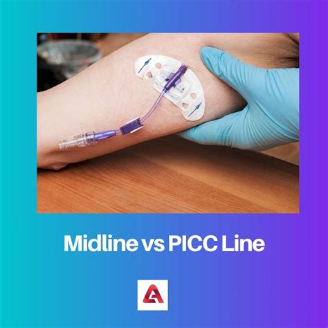 Midline vs PICC Line: Difference and Comparison