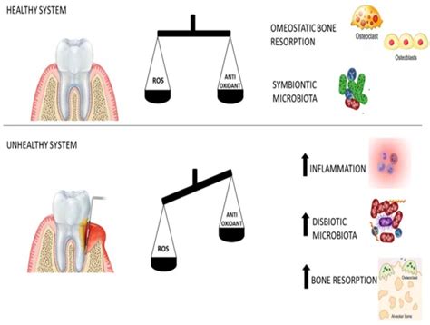 Evaluating the Role of Salivary Oxidative Stress Marker Malondialdehyde ...