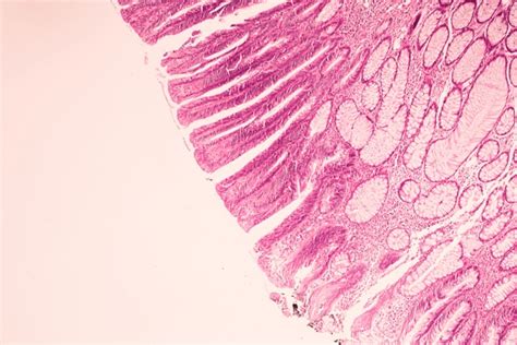 Image result for Brain Under Microscope