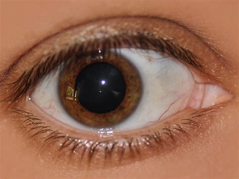 Mydriasis (Dilated Pupils): Causes And Treatment, 42% OFF