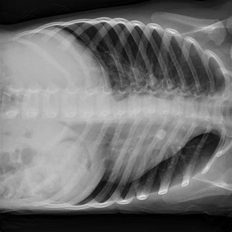 What Is The Meaning Of Lateral Decubitus Radiograph at William Butz blog