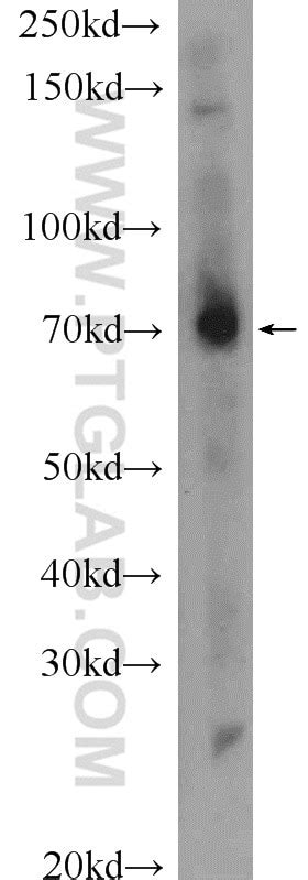 MPZL3 antibody (25513-1-AP) | Proteintech
