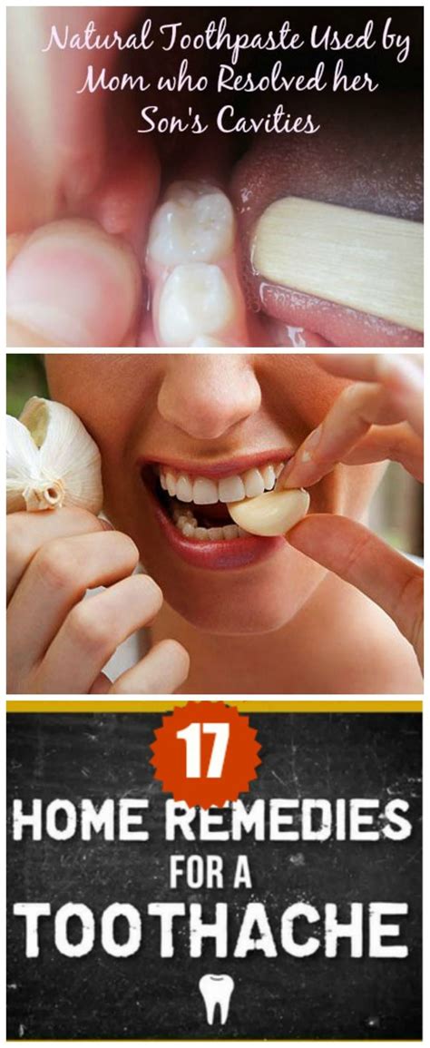 Natural Remedies For Gum Pain at Sam Vanthoff blog