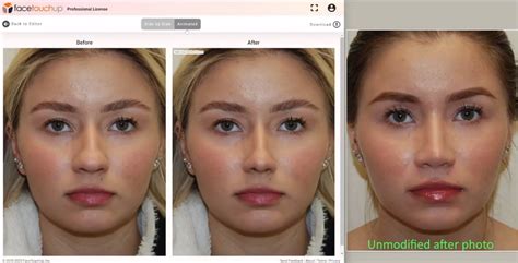 Discover the Power of Full Face Plastic Surgery Tools - Patelson.com