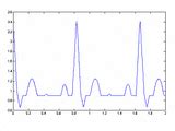 ECG Simulator Using MATLAB 的图像结果