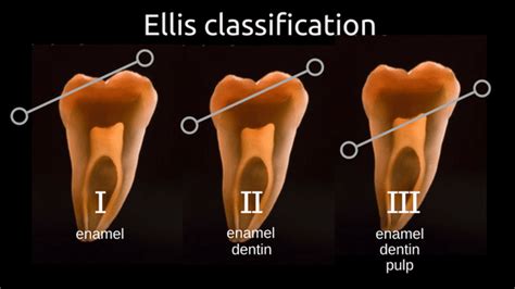 Image result for Graphical Abstract Examples of a Process