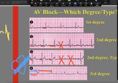Image result for ACLS Code Blue Algorithm