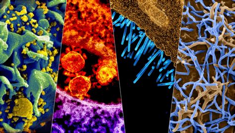 Is a Virus Alive or Not? – The Wire Science