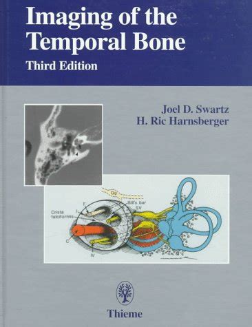 Buy Imaging of the Temporal Bone: 3 Book Online at Low Prices in India ...