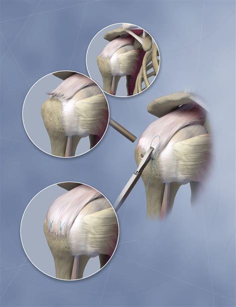 Shoulder Arthroscopy Anatomy