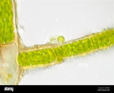 Plant Cell Chloroplast Microscope