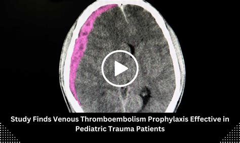 Study Finds Venous Thromboembolism Prophylaxis Effective in Pediatric ...