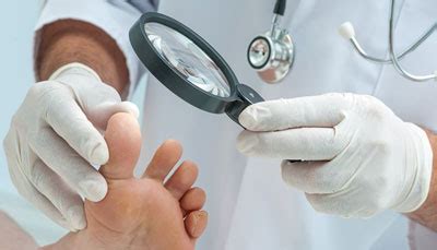 Preventing Foot Ulcers | Arogya Hospital Ludhiana | Dr. Ashish Ohri