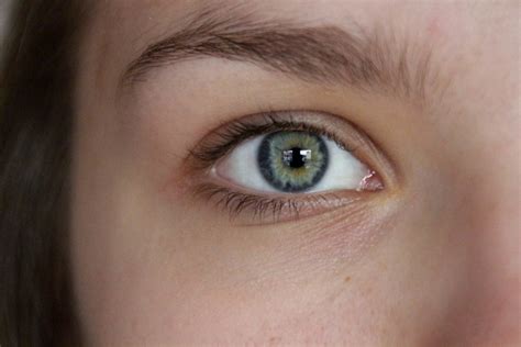 Why Does My Eye Keep Twitching? A Comprehensive Guide to Eyelid Myokymia