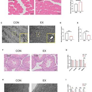 High Intensity Aerobic Exercise 的图像结果