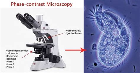 Image result for Phase Contrast Microscopy Applications