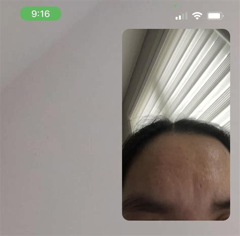 Beginning of en coupe de sabre? : r/scleroderma