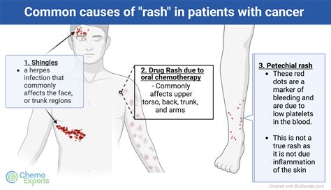 Skin Rash | ChemoExperts