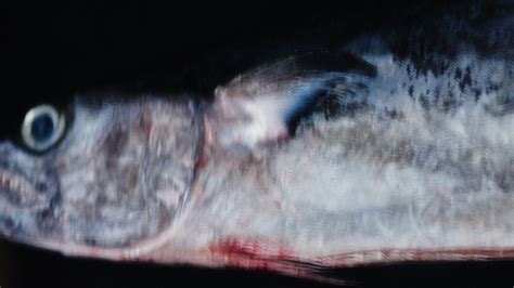 Life after mercury poisoning: The terrible legacy of Minamata