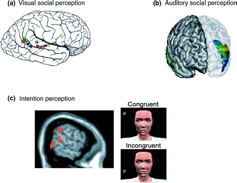 Superior Temporal Sulcus