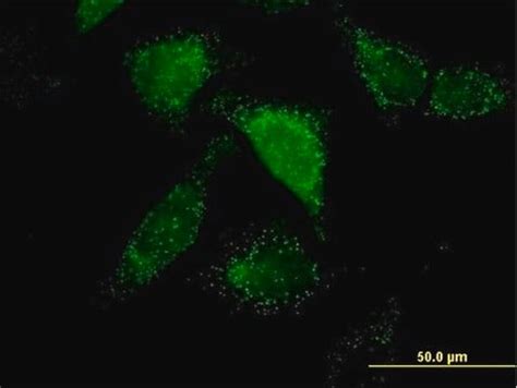 ACOX1 antibody Western, Immunofluorescence SAB1405420 ACOX