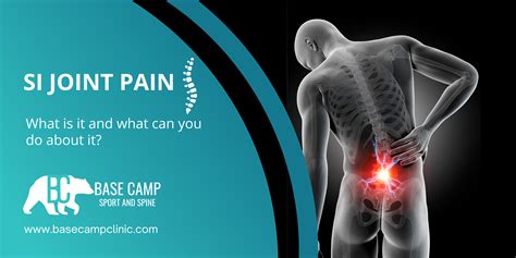 Sacroiliac Pain Pain In The Butt Series 2: Sacroiliac Joint Pain