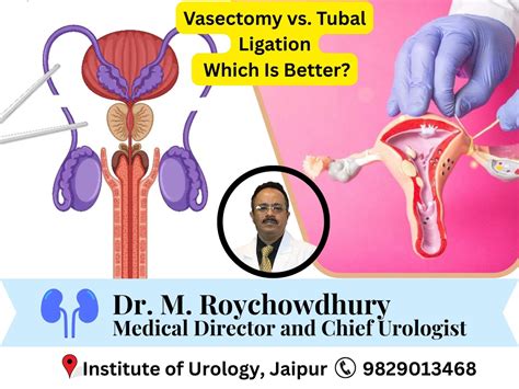 Vasectomy Vs Tubes Tied Cost | The Tube