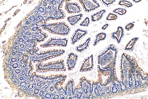 MARVELD2 antibody (13515-1-AP) | Proteintech