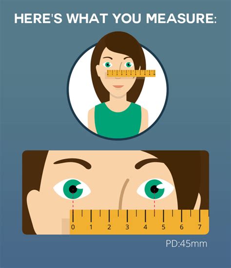 PD Prescription 的图像结果