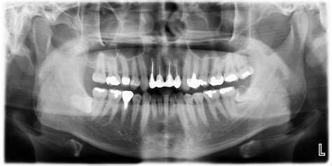 Image result for Teeth Computer
