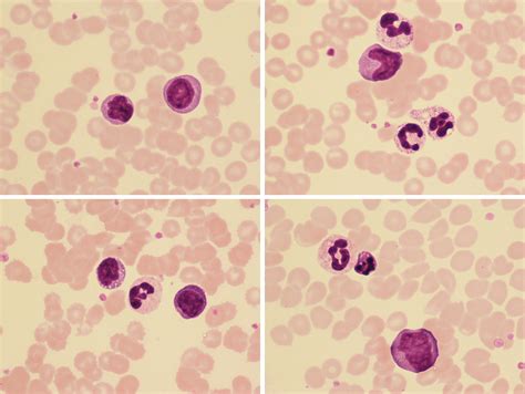 Image result for Lymphocytes Microscopic View