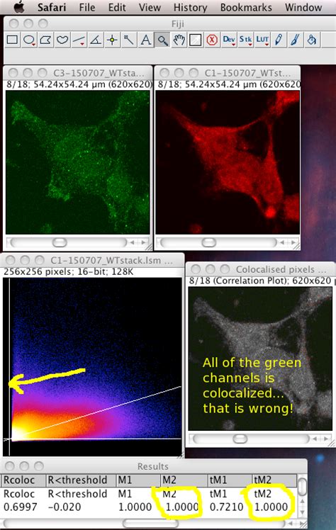 Image result for ImageJ Colocalization Coloc